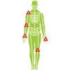 Joint arthritis example